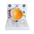 Gpi Anatomical Anatomical Model - Cataract Eye 2800